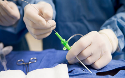 Aortic Valve Stenosis