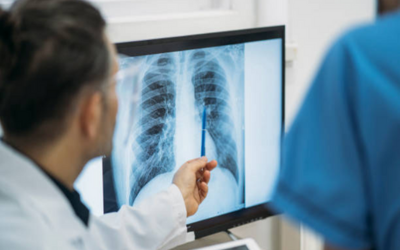 Pulmonary Valve Stenosis