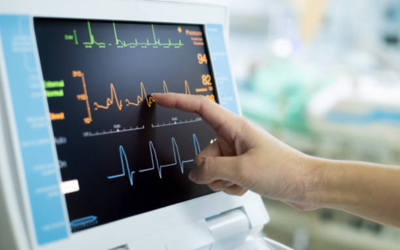 Congenital Mitral Valve Stenosis