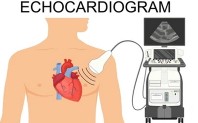 2D Echo - Dr Prashant Bobhate Pulmonary Valve Stenosis