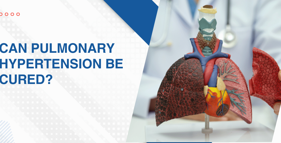 Can Pulmonary Hypertension Be Cured?