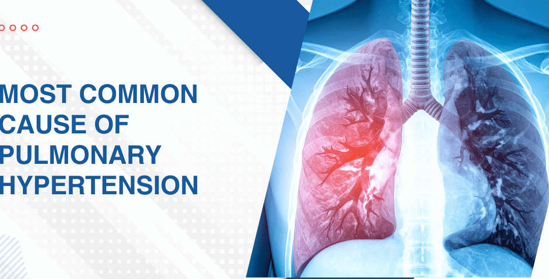 Most Common Cause of Pulmonary Hypertension
